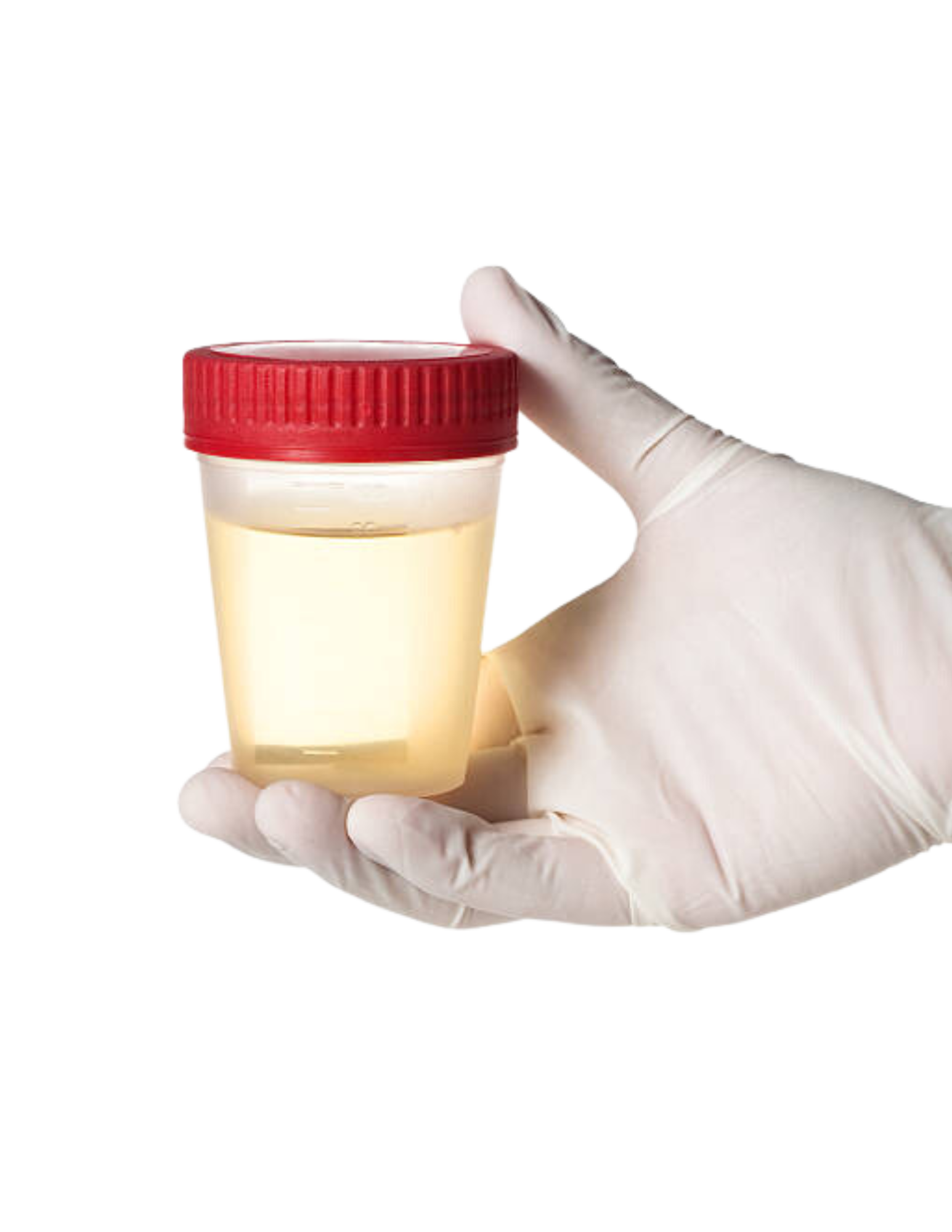 The Ultimate Guide To Fm 590Pp Non Dot Urine Testing - uklqlwp